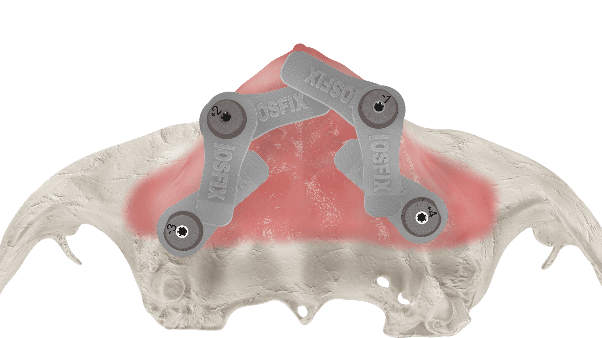 IOSFIX LITE aumenta la precisión de tus archivos.